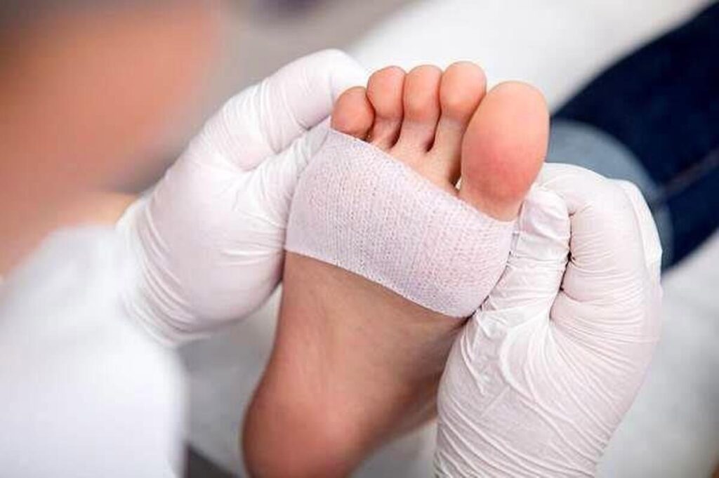 زخم پای دیابتی
