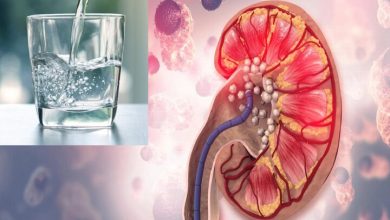 برای پیشگیری از سنگ کلیه، تنها نوشیدن آب کافی نیست